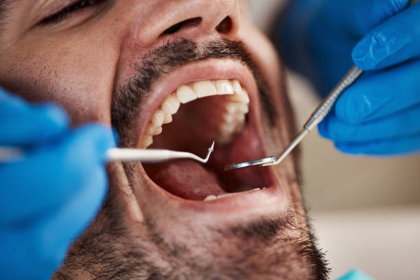 Best Pediatric Emergency Dentist in Salem, IL